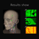 Vein Finder-UW-ZY-500